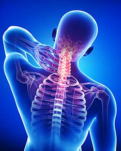 Upper spinal pain